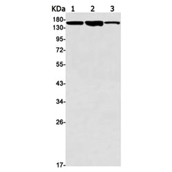 MET rabbit monoclonal antibody