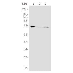 METTL3 rabbit monoclonal antibody