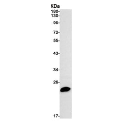 MGMT rabbit monoclonal antibody