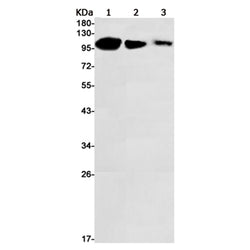 MIB1 rabbit monoclonal antibody