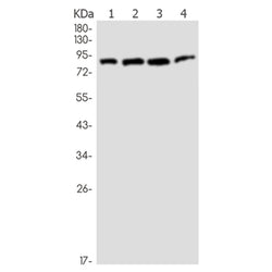 MLH1 rabbit monoclonal antibody