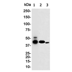 MMP12 rabbit monoclonal antibody