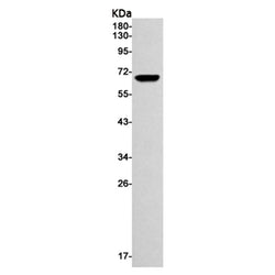 MMP14 rabbit monoclonal antibody