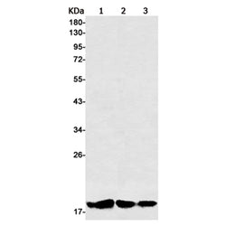 MMP26 rabbit monoclonal antibody