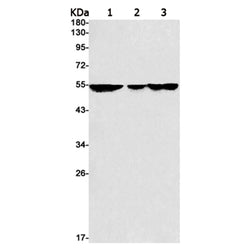 MMP3 rabbit monoclonal antibody
