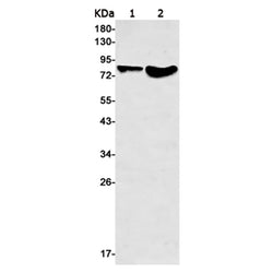 MMUT rabbit monoclonal antibody