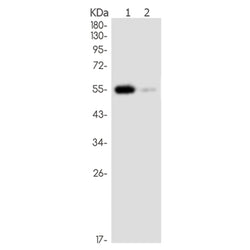 MPP1 rabbit monoclonal antibody