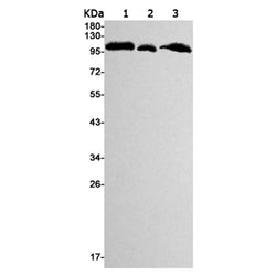 MSH2 rabbit monoclonal antibody