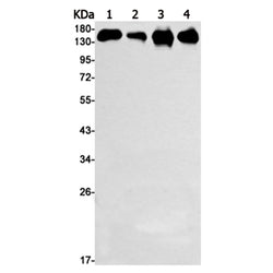 MSH6 rabbit monoclonal antibody