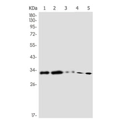MTAP rabbit monoclonal antibody