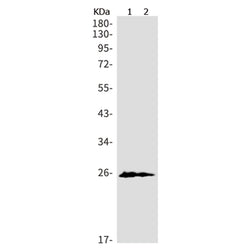 MUC1 rabbit monoclonal antibody