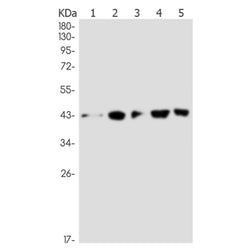 MVK rabbit monoclonal antibody