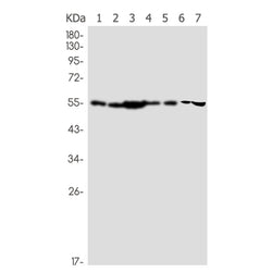 NAMPT rabbit monoclonal antibody