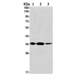 NAT1 rabbit monoclonal antibody