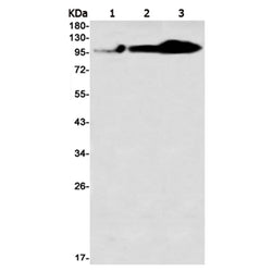 NCL rabbit monoclonal antibody