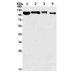 NCSTN rabbit monoclonal antibody