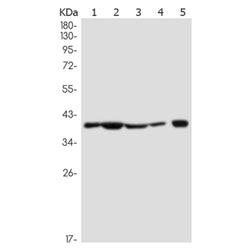 NDEL1 rabbit monoclonal antibody