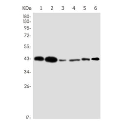NDRG1 (phospho-Ser330) rabbit monoclonal antibody