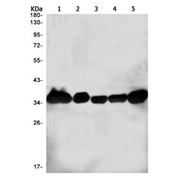 NDUFAF1 rabbit monoclonal antibody