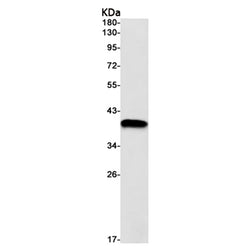NDUFAF5 rabbit monoclonal antibody