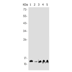 NDUFB2 rabbit monoclonal antibody
