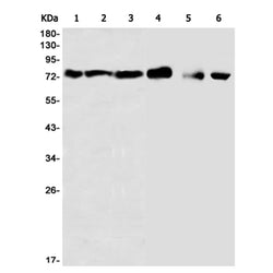 NDUFS1 rabbit monoclonal antibody