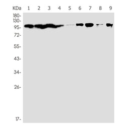 NEDD4 rabbit monoclonal antibody