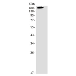 NEFH rabbit monoclonal antibody