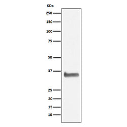 NEK7 rabbit monoclonal antibody
