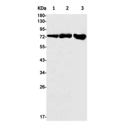 NF2 rabbit monoclonal antibody