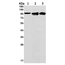 NFKB2 rabbit monoclonal antibody