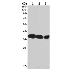 NKX2-1 rabbit monoclonal antibody