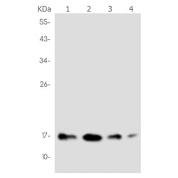NME1 rabbit monoclonal antibody