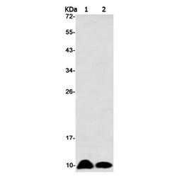 NOP10 rabbit monoclonal antibody