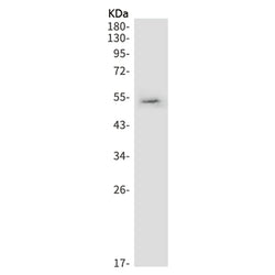 NOVA1 rabbit monoclonal antibody