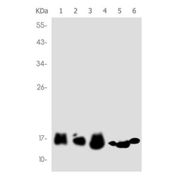 NPC2 rabbit monoclonal antibody