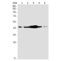 NR2F2 rabbit monoclonal antibody