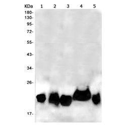 NRAS rabbit monoclonal antibody