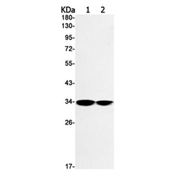 NTHL1 rabbit monoclonal antibody