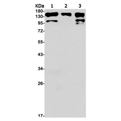 NTRK1/NTRK2 (phospho-Tyr490/Tyr516) rabbit monoclonal antibody