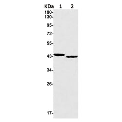 NUDT19 rabbit monoclonal antibody