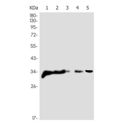 OLIG1 rabbit monoclonal antibody