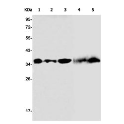 OTX1 rabbit monoclonal antibody