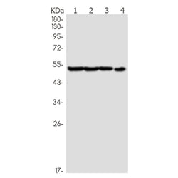 P2RY12 rabbit monoclonal antibody