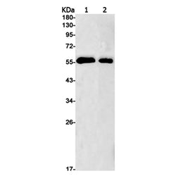 P4HB rabbit monoclonal antibody