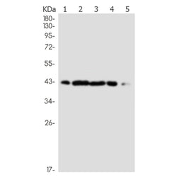 P4HTM rabbit monoclonal antibody