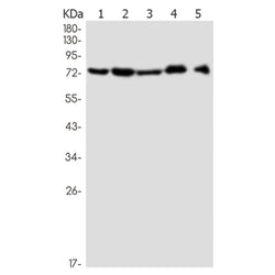 PAK4/PAK5/PAK6 (phospho-Ser474/Ser560/Ser602) rabbit monoclonal antibody