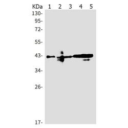 PARVA (phospho-Ser8) rabbit monoclonal antibody