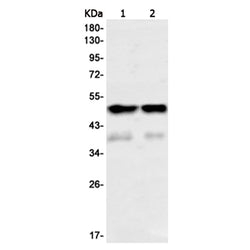 PAX6 rabbit monoclonal antibody