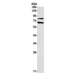 PCSK9 rabbit monoclonal antibody